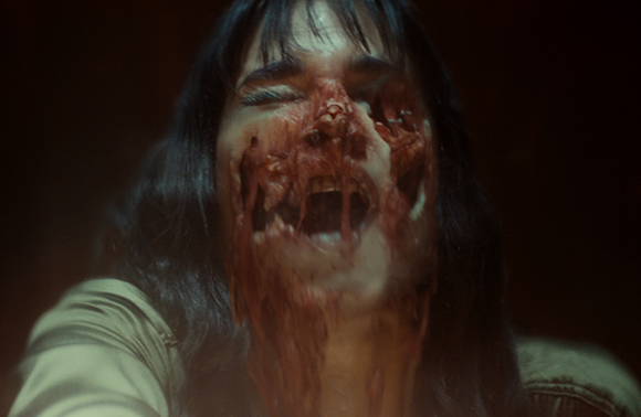 A person with significant facial injuries and exposed muscle and tissue.