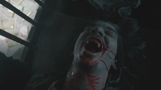 A person with blood on their face and neck screams with their mouth wide open in a dark setting.