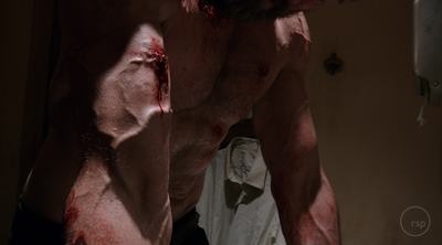 Close-up of a muscular, shirtless torso with several bloody lacerations and bruises.