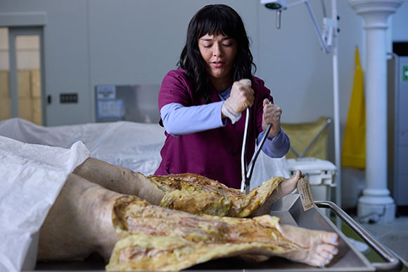 A person in a purple scrub top and gloves uses forceps to examine a dissected leg on a metal table in a morgue.