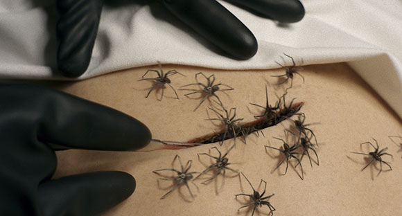 A close-up of a wound on skin with many spiders crawling on and around it. Black gloved hands are visible near the wound.