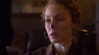 A woman with blonde hair and a bloody, damaged nose looks forward with a somber expression.