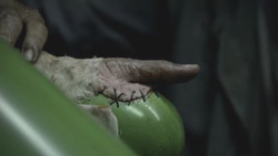 A wrinkled, pale hand with visible black stitches along the side resting on a smooth green surface.