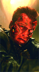 A man with deep red, textured facial scarring and a discolored eye looking forward.